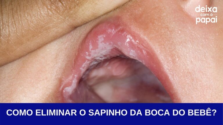 Como Administrar Mycostatin em Beb&ecirc;s