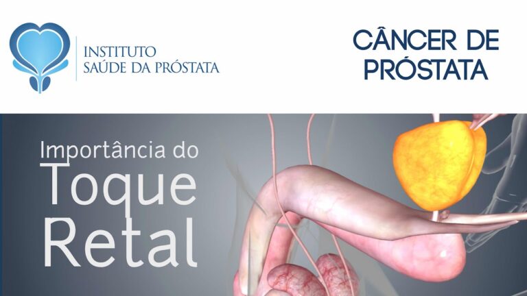 Como é Realizado o Exame da Próstata?