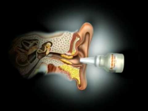 Como Usar o Spray de Cerúmen Eficazmente