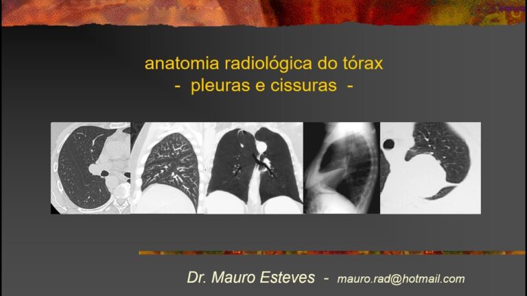 Cisurite Pulmonar: Causas, Sintomas e Tratamentos Eficazes