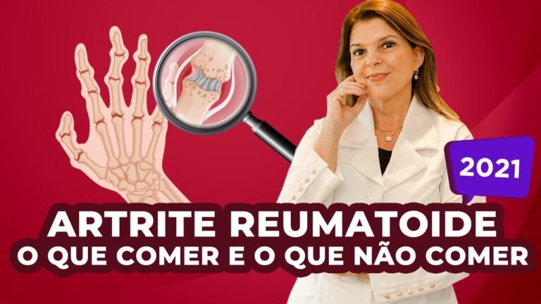 Alimenta&ccedil;&atilde;o Adequada para Controlar a Artrite Reumatoide