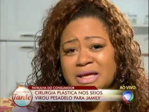 Transforma&ccedil;&otilde;es da Cirurgia Pl&aacute;stica do Seio