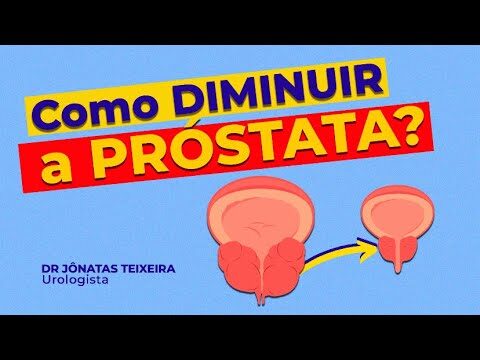 Estrat&eacute;gias Eficazes para Reduzir o Tamanho da Pr&oacute;stata