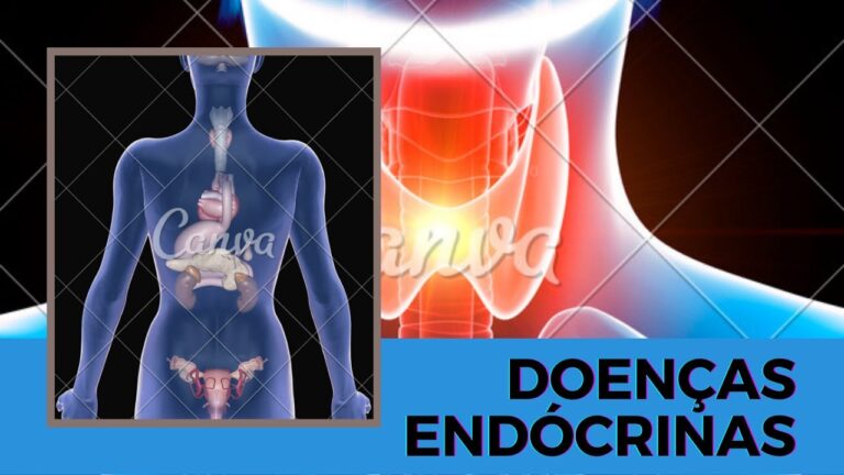 Entendendo as Doen&ccedil;as End&oacute;crinas: Causas e Tratamentos