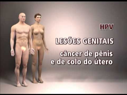 Entendendo o HPV: Imagens e Informa&ccedil;&otilde;es Essenciais