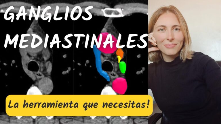 G&acirc;nglios Mediast&iacute;nicos: Import&acirc;ncia e Diagn&oacute;stico