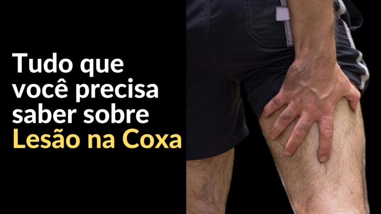 Preven&ccedil;&atilde;o e Tratamento de Les&otilde;es Musculares na Coxa