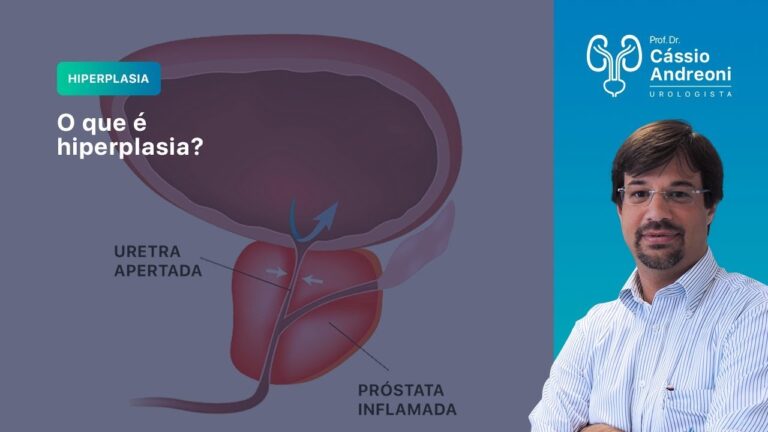 Hiperplasia Adenomatosa da Próstata: Causas, Sintomas e Tratamentos
