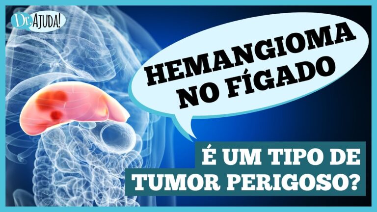 Sintomas do Hemangioma Hep&aacute;tico