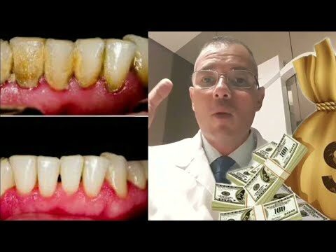 Limpeza Dental: Custos e Benef&iacute;cios
