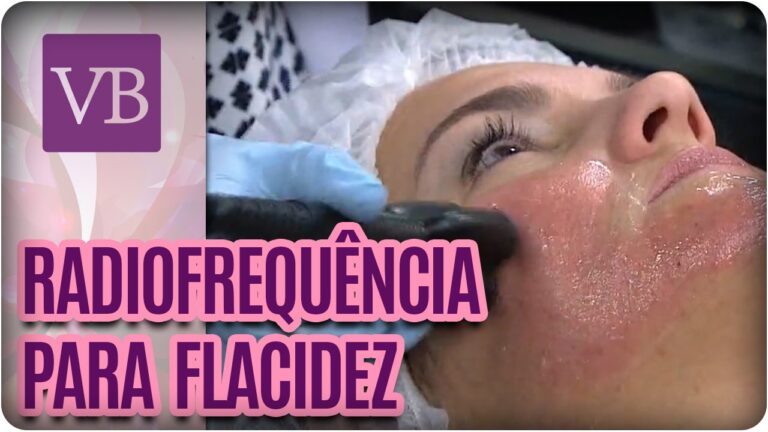 Transformação Facial: Resultados da Radiofrequência Antes e Depois