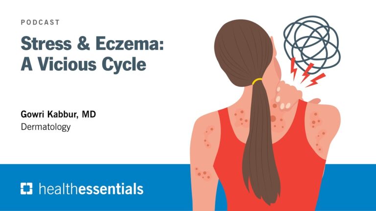 Eczema e Estresse: Conexões e Soluções Eficazes