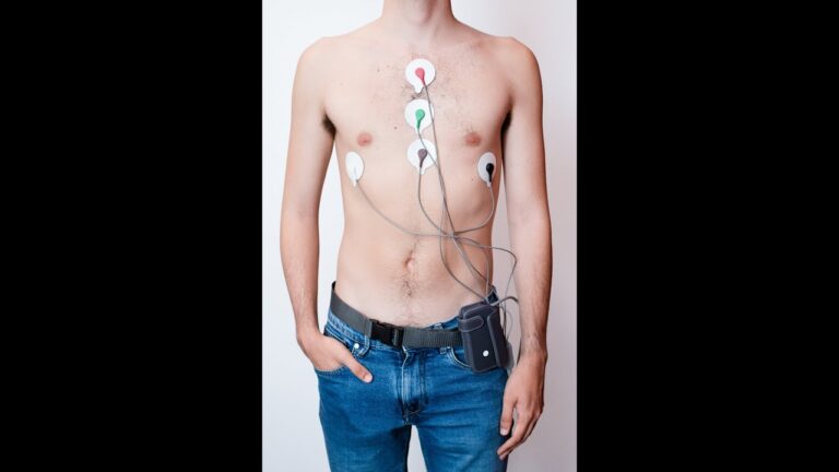 Entendendo o ECG Dinâmico com Holter: Benefícios e Aplicações