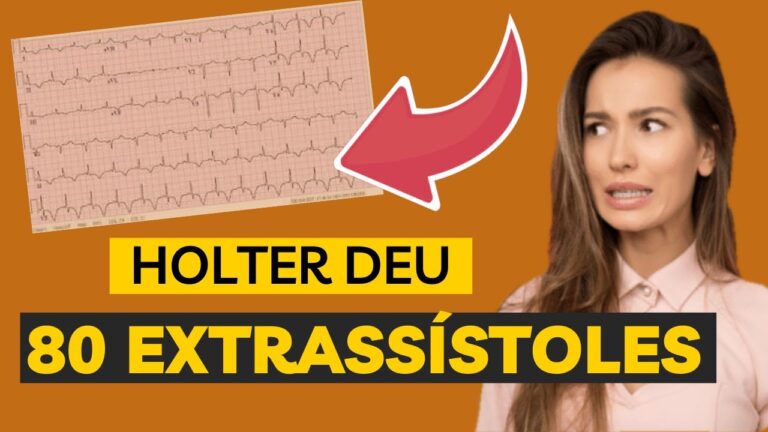 Como Interpretar os Resultados do Exame Holter